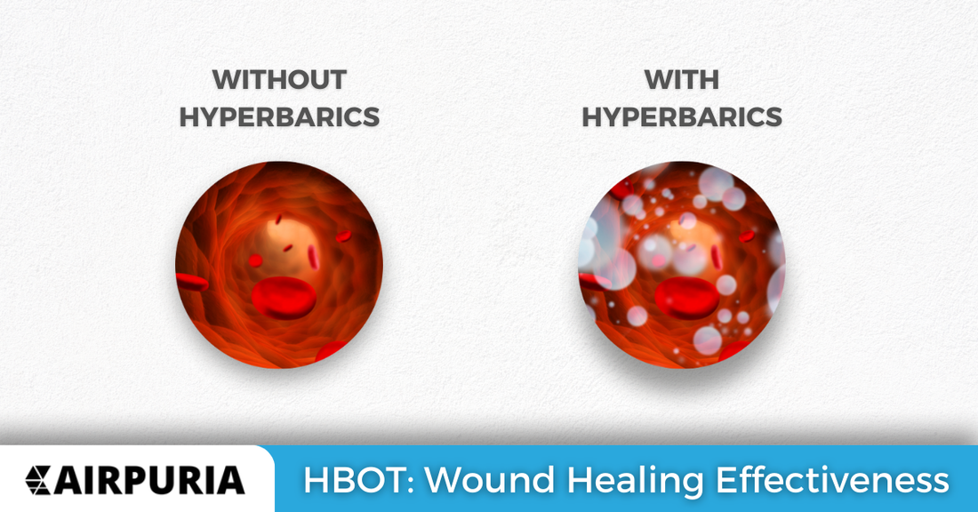Hyperbaric Oxygen Therapy: Wound Healing Effectiveness