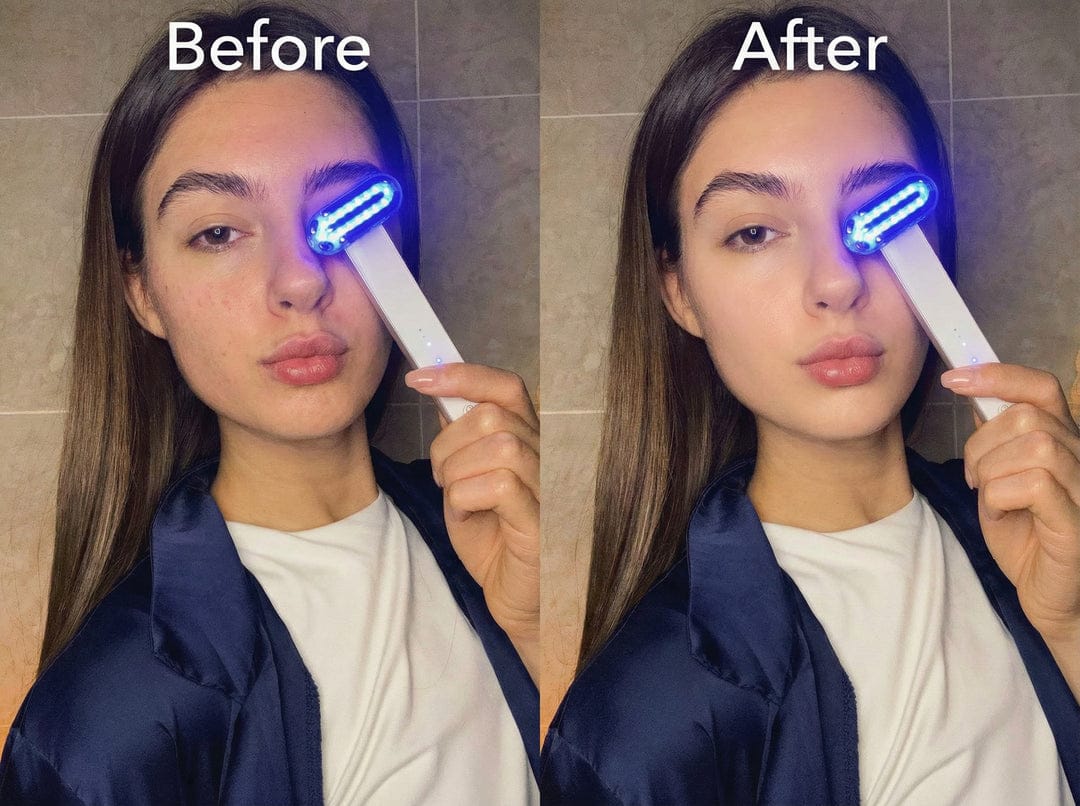 ZAQ Zayn 2.0 LED & Microcurrent 6-in-1 Facial Wand