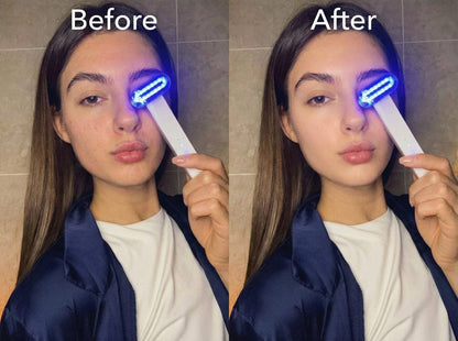 ZAQ Zayn 2.0 LED & Microcurrent 6-in-1 Facial Wand